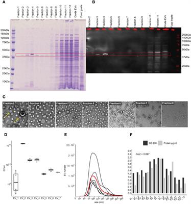 Fusobacterium nucleatum Extracellular Vesicles Modulate Gut Epithelial Cell Innate Immunity via FomA and TLR2